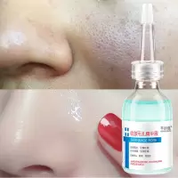 []不收缩毛孔退钱面部修复收缩毛孔精华液去粉刺祛痘水 收敛精华液*1瓶装