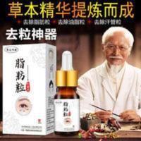 脂肪粒去除神器汗管油脂肪精华眼霜细纹植物淡化神器学生男女祛膏 10mL