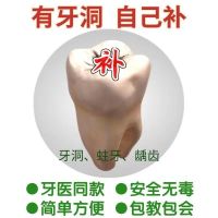 牙洞修复充填堵牙洞材料虫牙蛀牙龋齿补牙粉补牙洞牙粉胶水送工具 普通型