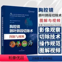 [正版]胸腔镜肺叶肺段切除术图解与视频 高文 主译 介绍胸腔镜肺叶和肺段切除的技术操作 静态图像 视频 上海科学技术出