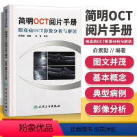 [正版] 简明OCT阅片手册 眼底病OCT影像分析与解读 俞素勤 OTC基本原理与技术 基础阅片影像眼科学视光技术应用