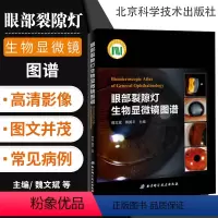 [正版] 眼部裂隙灯生物显微镜图谱 眼科多发病的治疗与鉴别诊断技术书籍 眼科学临床医学疾病在裂隙灯检查中的要点 978