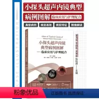 [正版]小探头超声内镜典型病例图解 临床应用与护理配合 董海燕 上消化道下消化道内镜小超检查黏膜病变肿瘤筛查书籍 山东