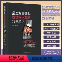[正版]显微根管外科疑难病例解析彩色图谱 王捍国 根尖周透射影根裂诊断鉴别非手术治疗显微根尖外科再植术牙髓病人民卫生出