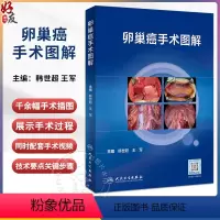 [正版]卵巢癌手术图解 韩世超王军 卵巢癌诊治指南黏液性瘤子宫内膜样瘤临床手术步骤视频腹腔镜 宫颈癌手术图解姊妹篇 人