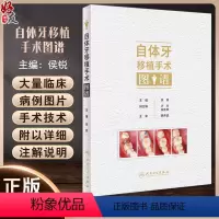[正版]自体牙移植手术图谱 侯锐编 口腔牙科种植手术评估操作预防根管治疗口腔科学临床病例医师参考书 人民卫生出版社97