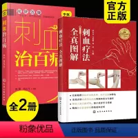 [正版]全2册 刺血疗法全真图解+刺血治百病 刺血疗法图书籍中国刺血疗法大全 中医针灸刺络放血疗法 放血疗法 中医刺络