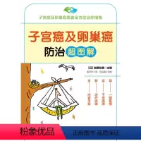[正版]图书子宫癌及卵巢癌防治超图解加藤友康978751809 63中国纺织出版社有限公司