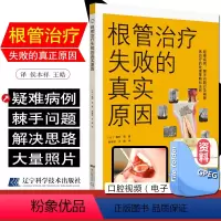 [正版] 根管治疗失败的真实原因 疑难病例 棘手问题以及根管再治疗的处理策略和法则 鶴町保 辽宁科学技术出版社9787