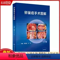 [正版]卵巢癌手术图解 配增值 人民卫生出版社9787117359573