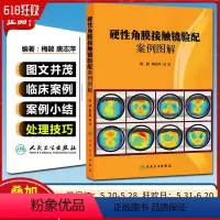 [正版] 硬性角膜接触镜验配案例图解 梅颖 唐志萍主编 人民卫生出版社 眼科学参考工具书籍眼角膜治疗图谱 978711