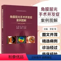 [正版]角膜屈光手术并发症案例图解 李莹 高华主编 配大量图片文字简洁适合屈光手术医师及眼表专业医师阅读人民卫生出版社