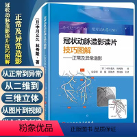 [正版]书冠状动脉造影读片技巧图解 正常及异常造影 教你从冠脉造影小白 快速进阶PCI达人 北京科学技术出版社书籍