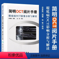 [正版] 简明OCT阅片手册俞素勤编著 基础阅片影像眼科学视光技术应用 人民卫生出版社眼底病OCT影像分析与解读医学类