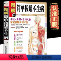 [正版]全方位图解版简单拔罐不生病彩绘版中医保健养生书籍家庭保健书拔罐教学 拔罐手法步奏穴位教学家庭拔罐实用疗法养生书