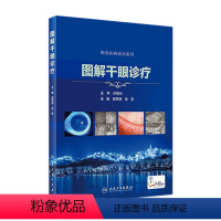 [正版]图解干眼诊疗 晋秀明徐雯主编 眼科学干眼症治疗干眼检查诊疗护理睑缘炎结膜角膜病变人民卫生出版社眼科书籍