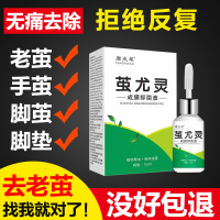 1盒 老茧去除软化剂鸡眼u膏贴祛脚茧子胼胝脚底死皮手上的硬皮专用神