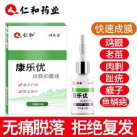 去除脚茧鸡眼膏贴老茧子肉刺足部老中医瘊子脚底死皮趾疣手关节茧脚上脚垫肉茧软化剂脚底膏厚硬茧子足膜