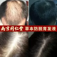 同仁堂育发液1瓶装 其他/other 同仁堂洗发水育发液生姜头皮护理洗发液密发液改善毛躁滋养柔顺女