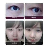 扩眼精油开眼角双眼皮神器精华液变双眼皮眼部松弛护理精油