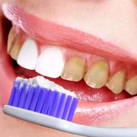 冰博士牙齿亮白益生菌洗牙粉清洁牙渍牙黄牙垢炫白晶澈洁牙粉净澈