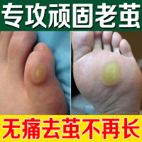 15ml 去老茧脚茧脚底厚死皮软化剂脚垫胼胝去除膏脚掌小脚趾关节茧神器