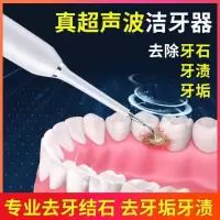 牙齿抛光器牙科清洁牙齿器儿童洗牙器家用超声波洗牙器