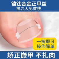 甲沟矫正器专用脚趾甲往肉里长炎正甲贴嵌甲神器正甲丝纠正器8138P
