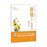 肝癌看了就明白