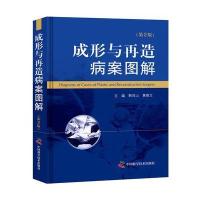 成形与再造病案图解