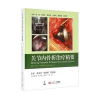 关节内骨折治疗精要