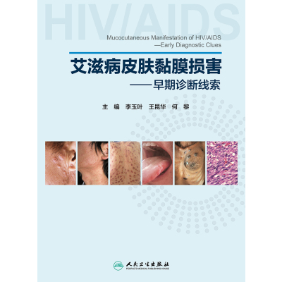 艾滋病皮肤黏膜损害——早期诊断线索