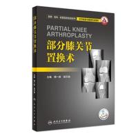 部分膝关节置换术(配增值)