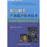 [M]胎儿畸形产前超声检查技术-9787502367657