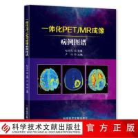 一体化PET/MR成像病例图谱