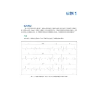 惠典正版正版 应用心电图定位室性心律失常的起源与消融 凌天佑 吴立群 主译 北京大学医学出版社54P8WT