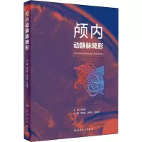 颅内动静脉畸形