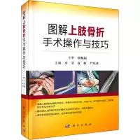 图解上肢骨折手术操作与技巧