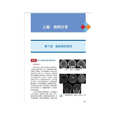 宫剑小儿神经外科手术笔记 1