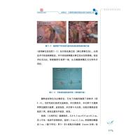 中国医学科学院肿瘤医院胃癌病例精解