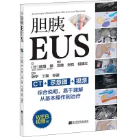 胆胰EUS