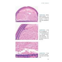 皮肤病病例精粹——从临床到病理(第2辑)