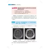 影像诊断技巧---要点与盲点1