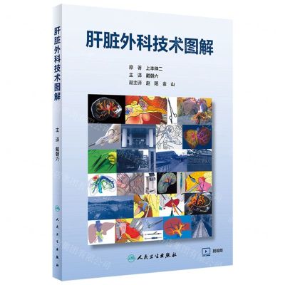 [N]肝脏外科技术图解(附光盘)-9787117330107