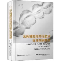 无托槽隐形矫治技术拔牙病例精粹