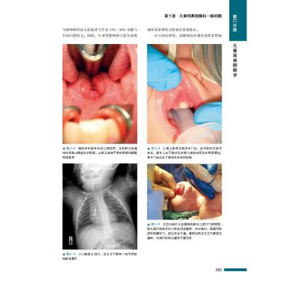 Cummings耳鼻咽喉头颈外科学 第6分册 儿童耳鼻咽喉学 原书第6版