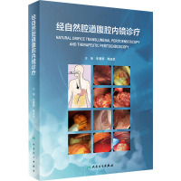 经自然腔道腹腔内镜诊疗