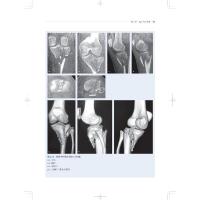 AO创伤骨科治疗关键点 从失败中学习