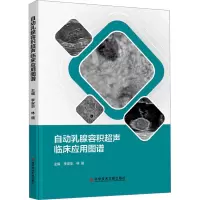 自动乳腺容积超声临床应用图谱