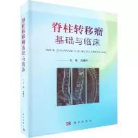 脊柱转移瘤基础与临床